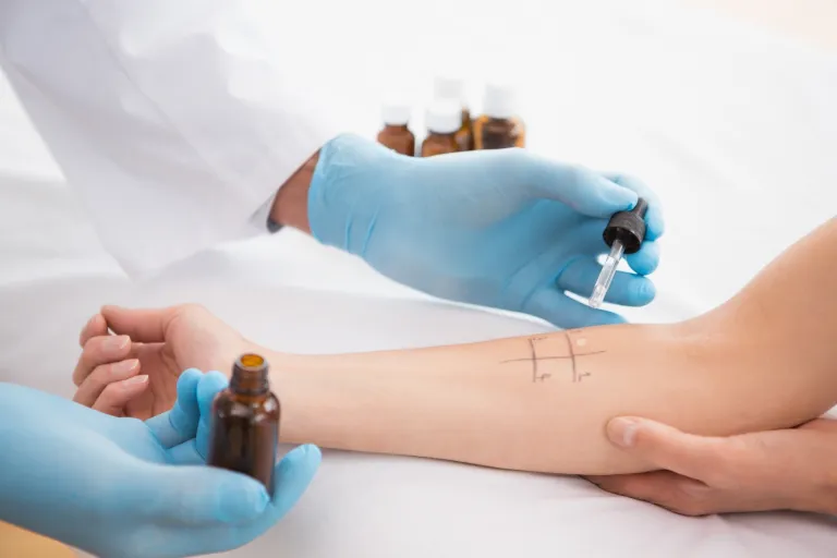Prick test