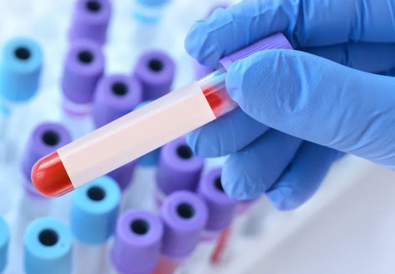 Diater. Betalactams diagnostic tests